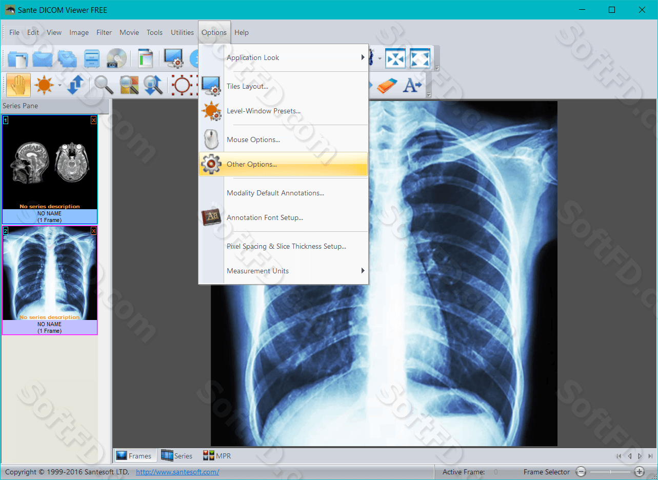 instal the new for android Sante DICOM Editor 8.2.5 instal the new for android Sante DICOM Editor 8.2.5