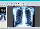 Sante DICOM Editor 8.2.5 free Sante DICOM Editor 8.2.5 free