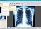 Sante DICOM Viewer FREE - Screenshot 03