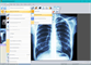Sante DICOM Viewer FREE - Screenshot 04