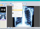 Sante DICOM Viewer Pro 12.2.5 instal the last version for windows