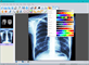 Sante DICOM Viewer FREE - Screenshot 09